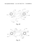 LORDOTIC EXPANDABLE INTERBODY IMPLANT AND METHOD diagram and image