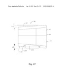 LORDOTIC EXPANDABLE INTERBODY IMPLANT AND METHOD diagram and image