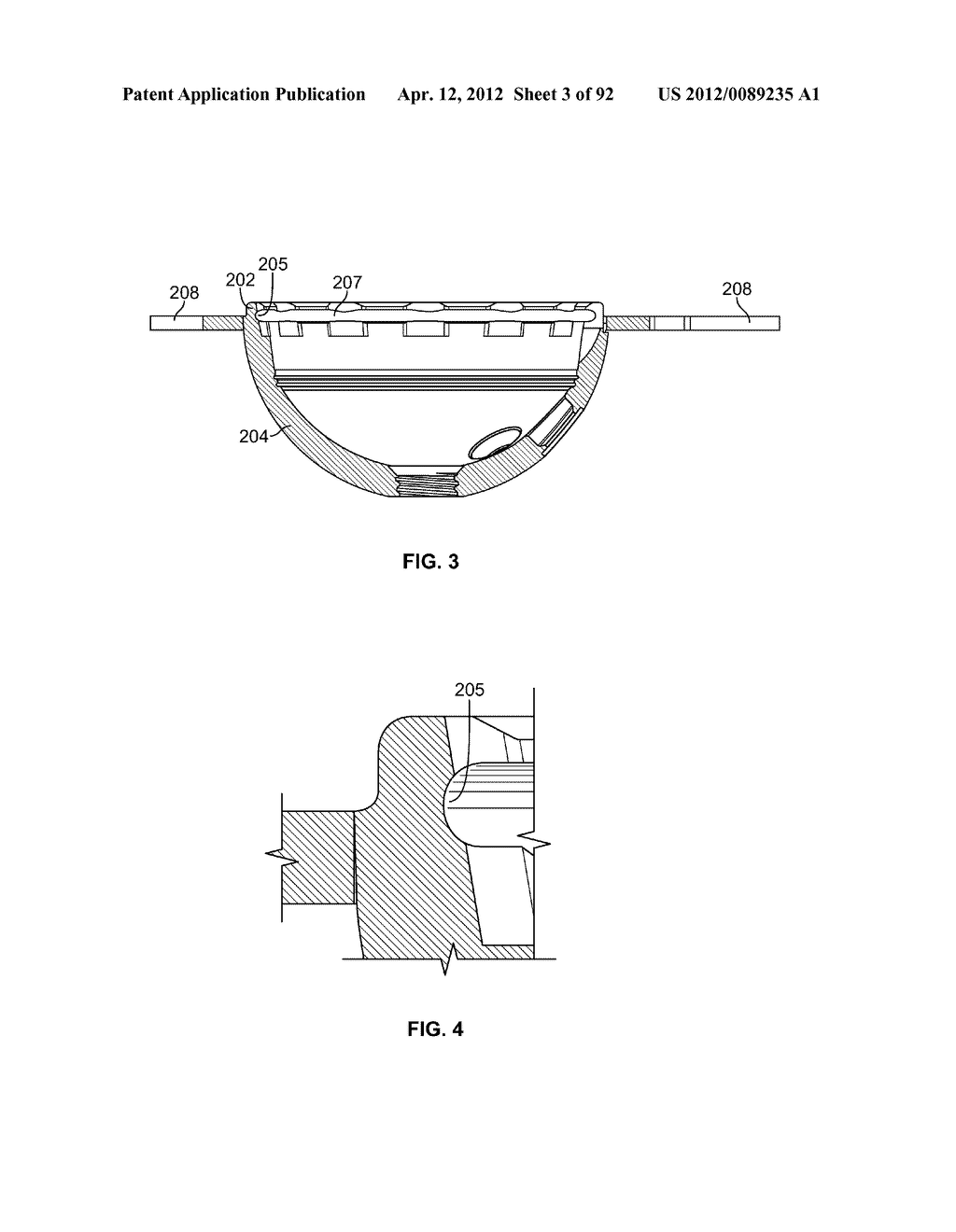 IMPLANT COMPONENTS AND METHODS - diagram, schematic, and image 04