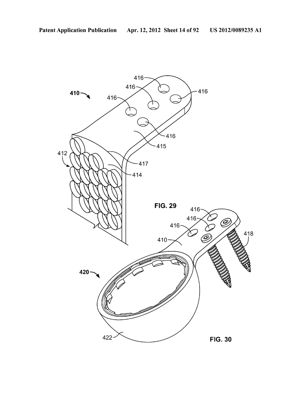 IMPLANT COMPONENTS AND METHODS - diagram, schematic, and image 15