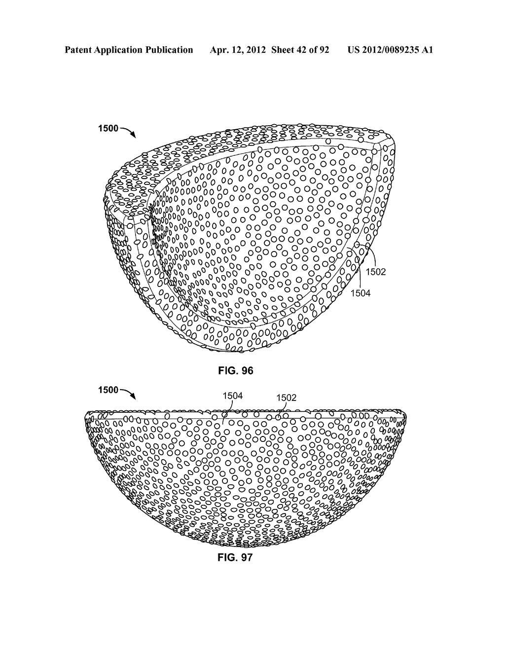 IMPLANT COMPONENTS AND METHODS - diagram, schematic, and image 43