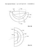 IMPLANT COMPONENTS AND METHODS diagram and image