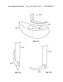 IMPLANT COMPONENTS AND METHODS diagram and image