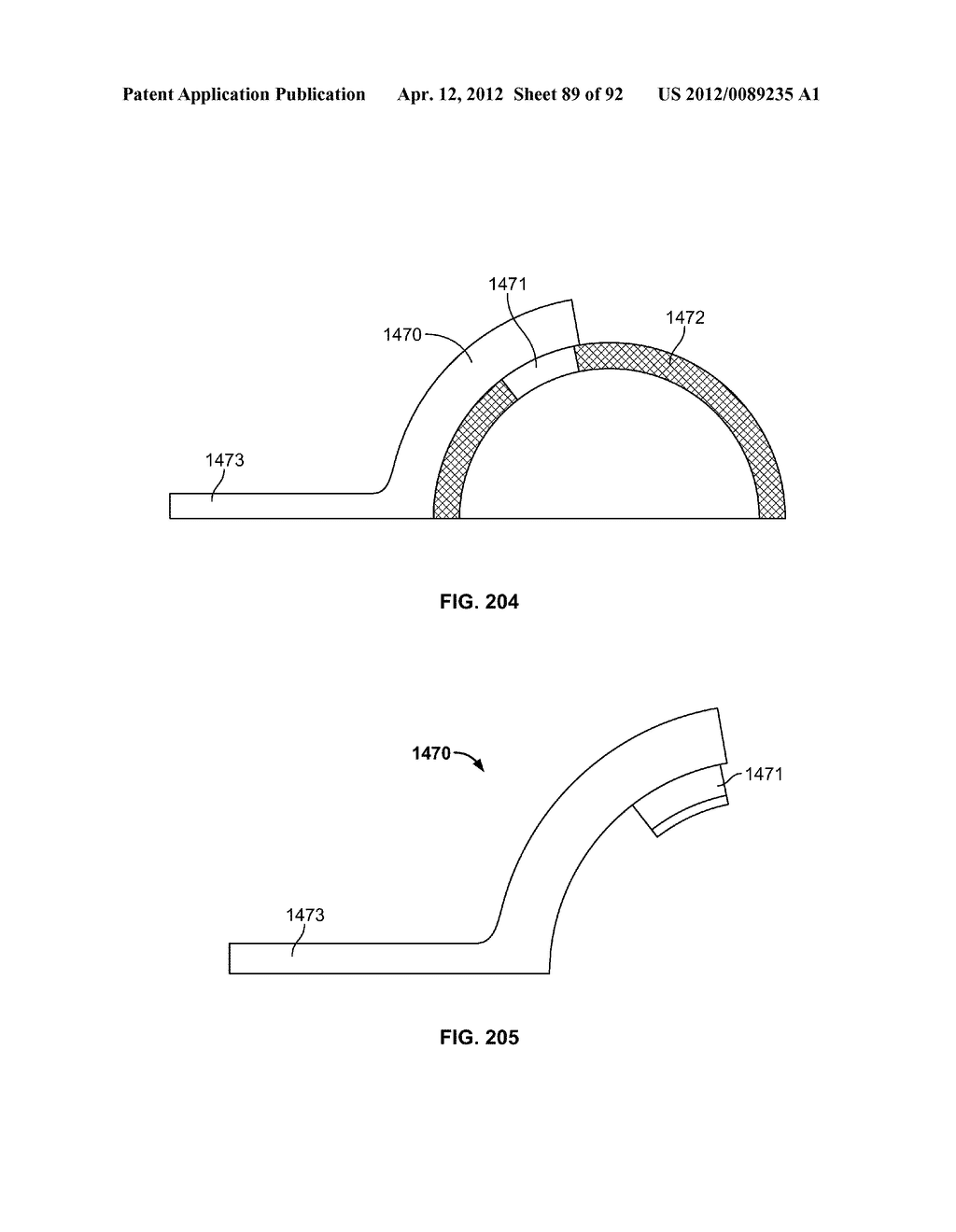 IMPLANT COMPONENTS AND METHODS - diagram, schematic, and image 90