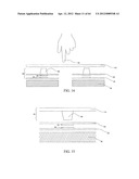 Sensor having a set of plates, and method diagram and image