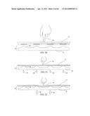 Sensor having a set of plates, and method diagram and image