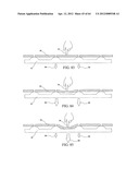 Sensor having a set of plates, and method diagram and image