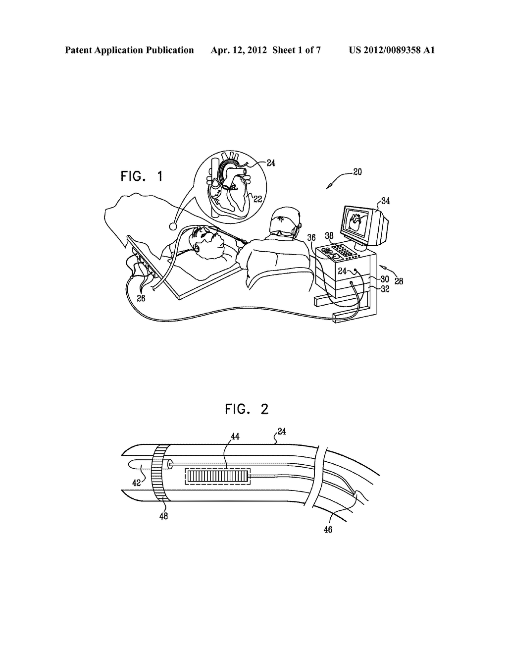 CALIBRATION SYSTEM FOR A FORCE-SENSING CATHETER - diagram, schematic, and image 02