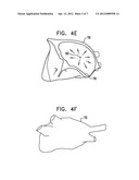 CALIBRATION SYSTEM FOR A FORCE-SENSING CATHETER diagram and image