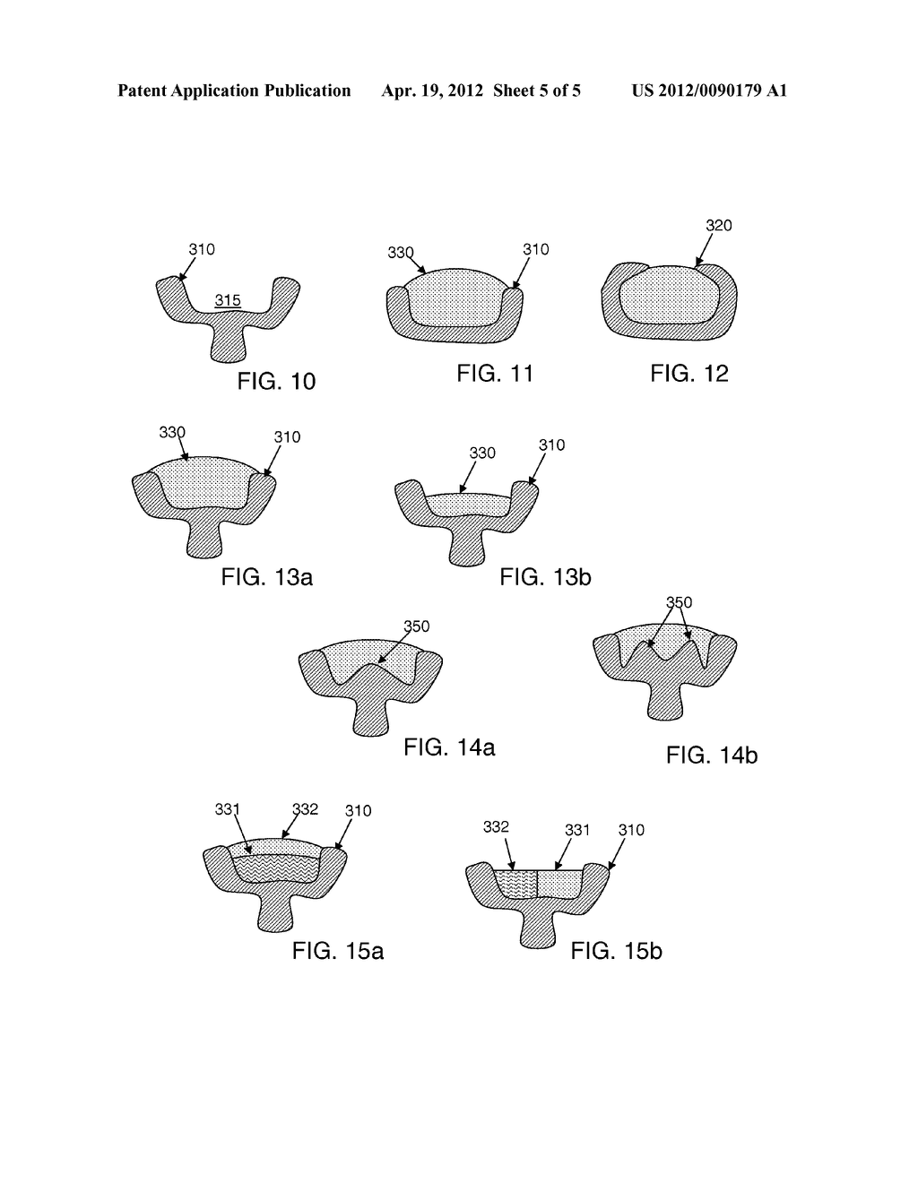 Skin Engaging Member Forming A Ring - diagram, schematic, and image 06