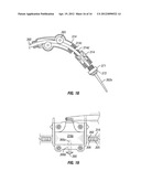 Anchoring System for a Kayak diagram and image