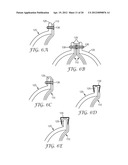 ENCLOSURE FOR A CABLE CONNECTION diagram and image