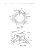 ENCLOSURE FOR A CABLE CONNECTION diagram and image