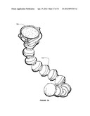 Attachment Clips for Support Structures diagram and image