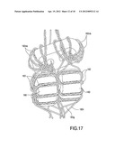 TOROID WITH CHANNELS AND CIRCUIT ELEMENT AND MODULAR JACK WITH SAME diagram and image