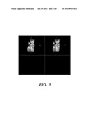 APPARATUS AND METHOD FOR A REAL-TIME MULTI-VIEW THREE-DIMENSIONAL     ULTRASONIC IMAGE USER INTERFACE FOR ULTRASONIC DIAGNOSIS SYSTEM diagram and image