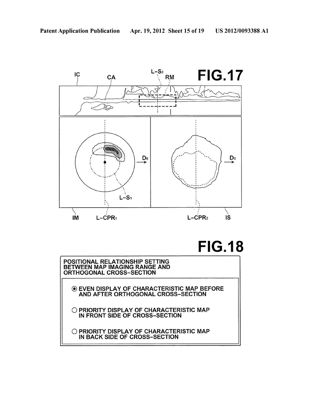 MEDICAL IMAGE PROCESSING APPARATUS, METHOD, AND PROGRAM - diagram, schematic, and image 16