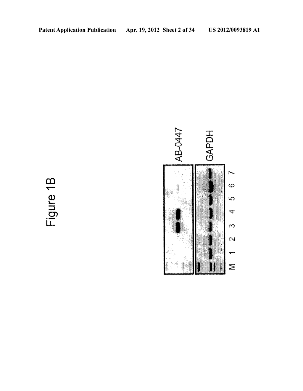 ANTIBODIES THAT SPECIFICALLY BLOCK THE BIOLOGICAL ACTIVITY OF A TUMOR     ANTIGEN - diagram, schematic, and image 03