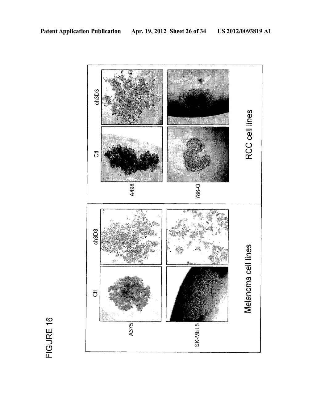 ANTIBODIES THAT SPECIFICALLY BLOCK THE BIOLOGICAL ACTIVITY OF A TUMOR     ANTIGEN - diagram, schematic, and image 27