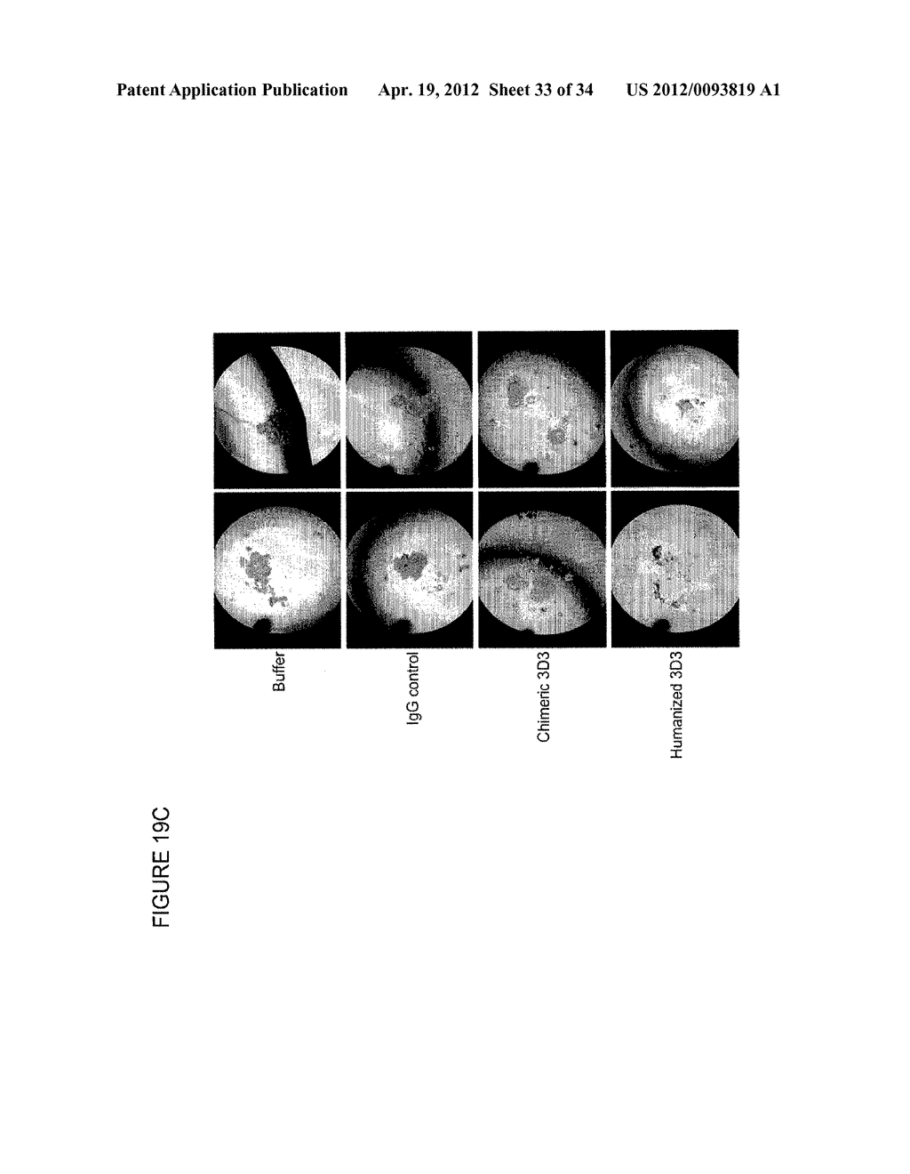 ANTIBODIES THAT SPECIFICALLY BLOCK THE BIOLOGICAL ACTIVITY OF A TUMOR     ANTIGEN - diagram, schematic, and image 34