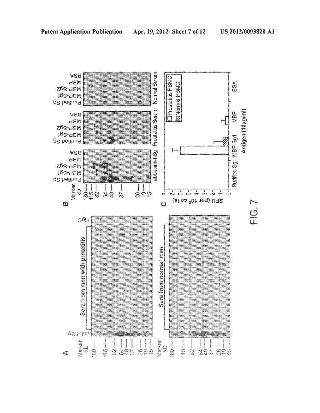 Prostatitis-Associated Antigens and Methods of Use Thereof - diagram, schematic, and image 08