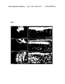 PROMOTION OF NEURONAL INTEGRATION IN NEURAL STEM CELL GRAFTS diagram and image