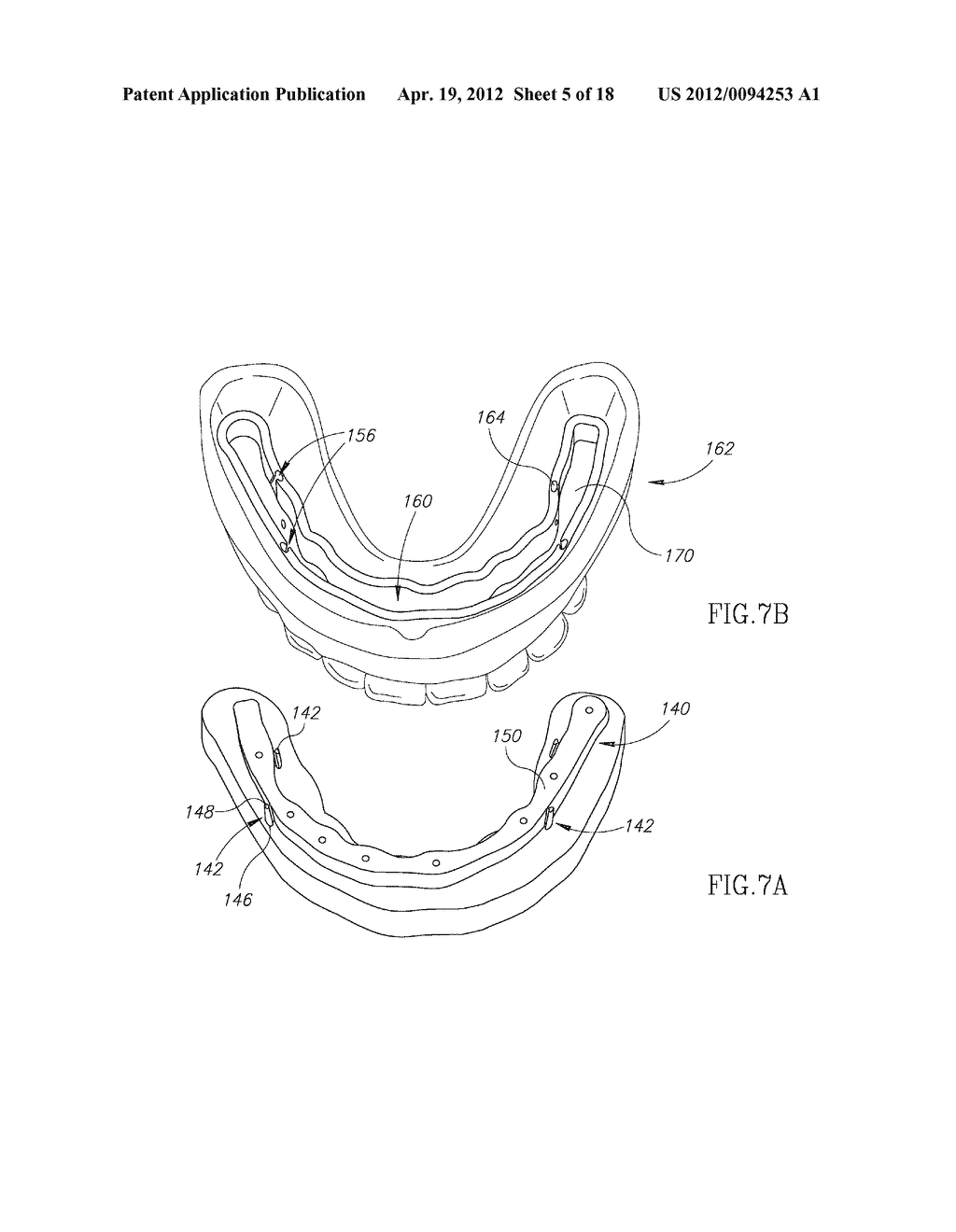 DENTURE STABILIZATION SYSTEM AND METHOD - diagram, schematic, and image 06