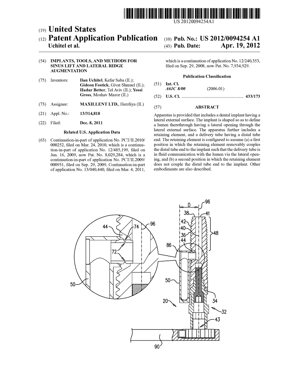 IMPLANTS, TOOLS, AND METHODS FOR SINUS LIFT AND LATERAL RIDGE AUGMENTATION - diagram, schematic, and image 01