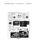 Bin1 as a Prognostic Marker in Cardiovascular Disease diagram and image