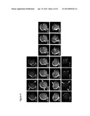 IMAGING AND EVALUATING EMBRYOS, OOCYTES, AND STEM CELLS diagram and image