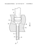 NEEDLE ARRAY ASSEMBLY AND METHOD FOR DELIVERING THERAPEUTIC AGENTS diagram and image