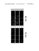 DETECTION OF CIRCULATING TUMOR CELLS IN PERIPHERAL BLOOD WITH AN AUTOMATED     SCANNING FLUORESCENCE MICROSCOPE diagram and image