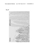 COMPOSITIONS AND METHODS TO MODULATE PROGRESSION AND ONSET OF INFLAMMATORY     BOWEL DISEASE diagram and image