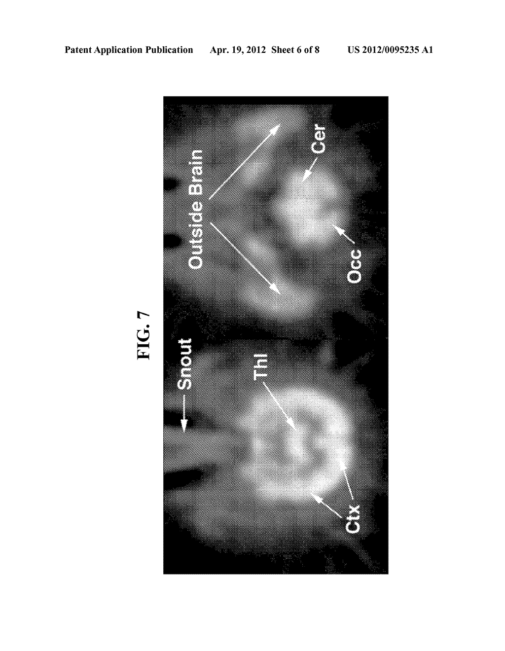 THIOFLAVIN DERIVATES FOR USE IN THE ANTEMORTEM DIAGNOSIS OF ALZHEIMER'S     DISEASE AND IN VIVO IMAGING AND PREVENTION OF AMYLOID DEPOSITION - diagram, schematic, and image 07