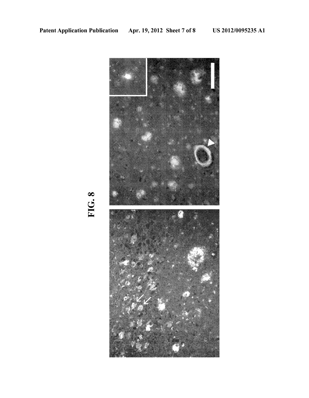 THIOFLAVIN DERIVATES FOR USE IN THE ANTEMORTEM DIAGNOSIS OF ALZHEIMER'S     DISEASE AND IN VIVO IMAGING AND PREVENTION OF AMYLOID DEPOSITION - diagram, schematic, and image 08