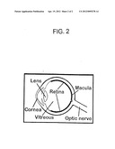 Beta Radiotherapy Emitting Surgical Device And Methods of Use Thereof diagram and image