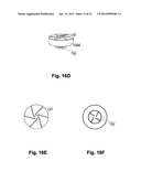 HEART PUMP CONTROLLER diagram and image