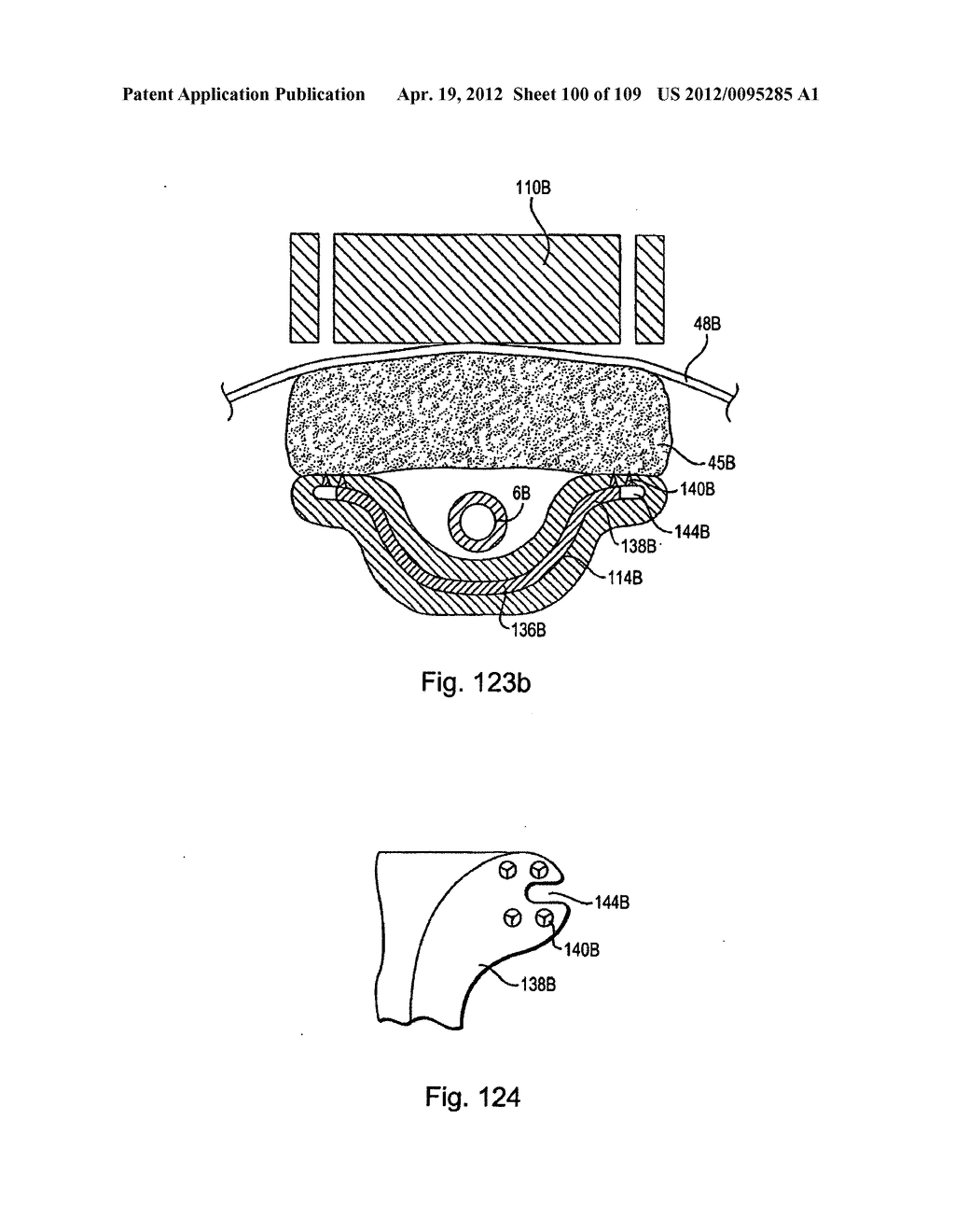 SYSTEMS, DEVICES, AND METHODS FOR MINIMALLY INVASIVE PELVIC SURGERY - diagram, schematic, and image 101