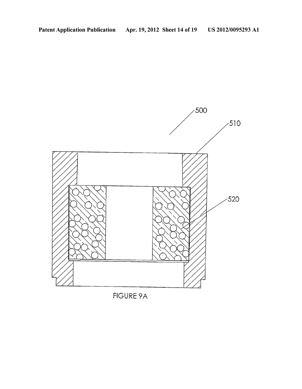 COMBINED IRRIGATION AND RINSING TUBE SET - diagram, schematic, and image 15