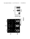 TREATMENT OF BRAIN DISEASES VIA ULTRASOUND/MAGNETIC TARGETING DELIVERY AND     TRACING OF THERAPEUTIC AGENTS diagram and image