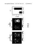 TREATMENT OF BRAIN DISEASES VIA ULTRASOUND/MAGNETIC TARGETING DELIVERY AND     TRACING OF THERAPEUTIC AGENTS diagram and image