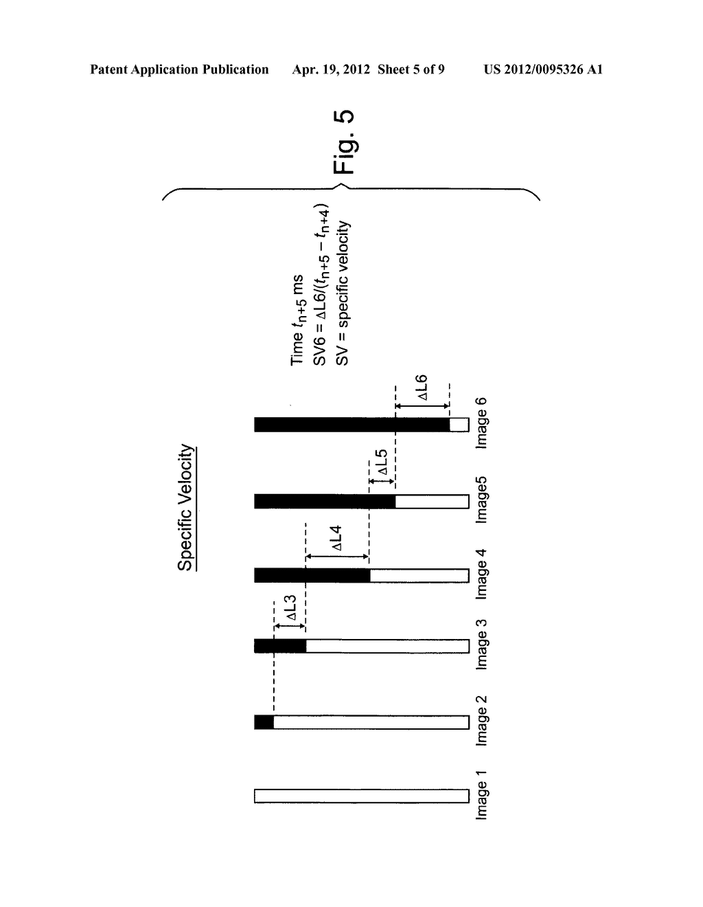 Velocity measurement of MR-Imaged fluid flows - diagram, schematic, and image 06