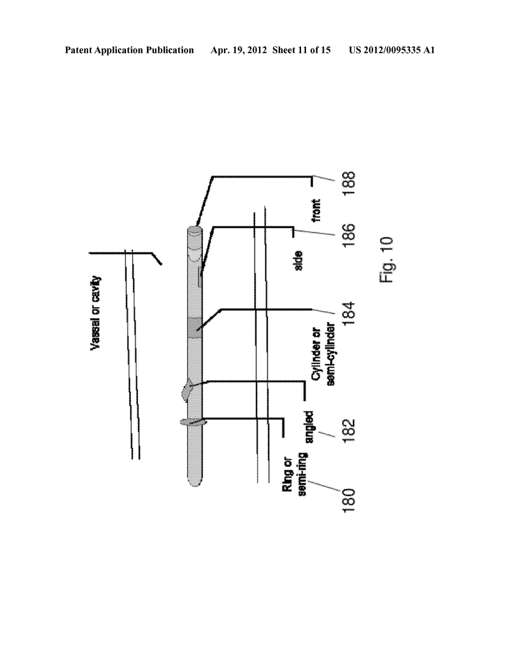 ULTRASOUND TRANSDUCER AND USES THEREOF - diagram, schematic, and image 12