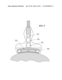 Concave Ultrasound Transducers and 3D Arrays diagram and image