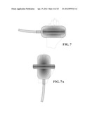 Concave Ultrasound Transducers and 3D Arrays diagram and image