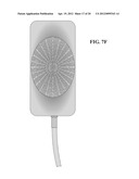 Concave Ultrasound Transducers and 3D Arrays diagram and image