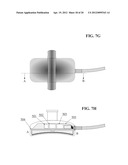 Concave Ultrasound Transducers and 3D Arrays diagram and image