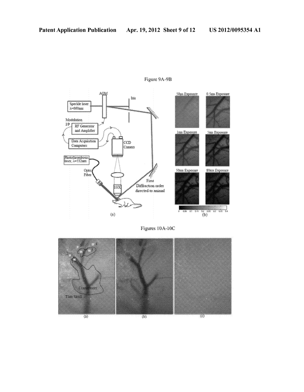 QUANTITATIVE IMAGING WITH MULTI-EXPOSURE SPECKLE IMAGING (MESI) - diagram, schematic, and image 10