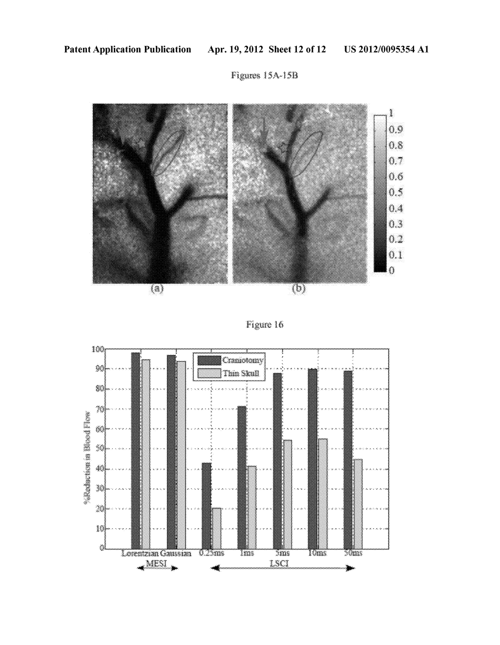 QUANTITATIVE IMAGING WITH MULTI-EXPOSURE SPECKLE IMAGING (MESI) - diagram, schematic, and image 13