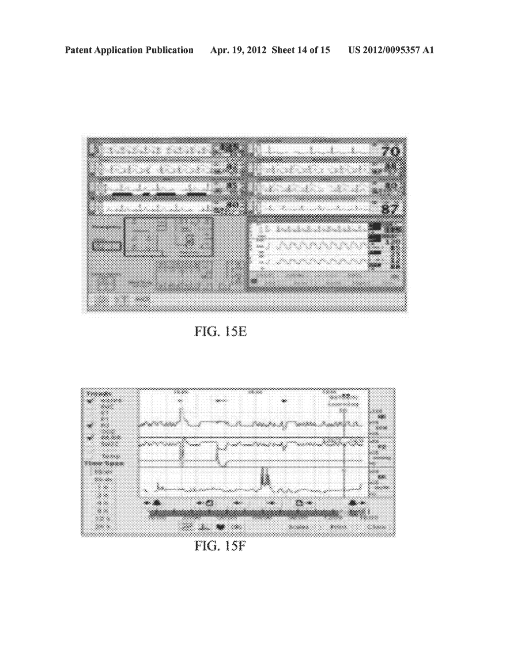 HEALTH MONITORING APPLIANCE - diagram, schematic, and image 15